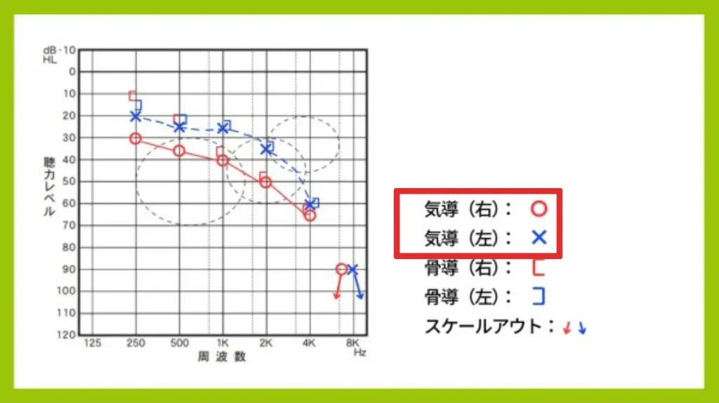 オージオグラムの画像、丸が右耳、バツが左耳という説明に赤い囲い
